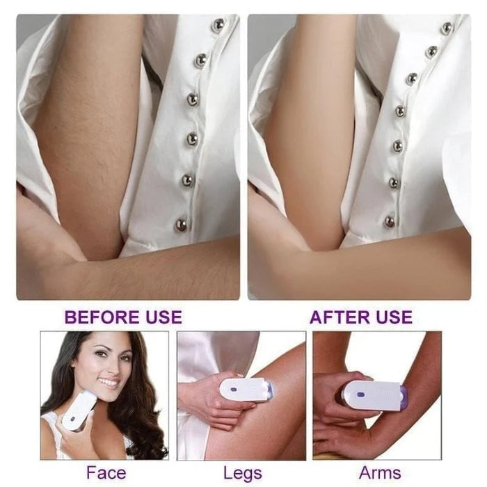🔥BIG SALE - 49% OFF🔥 Silky Smooth Hair Removal