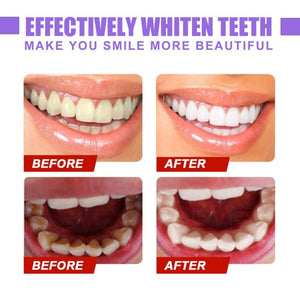 🔥LETZTER TAG 49 % RABATT🔥Serum zur Farbkorrektur der Zähne